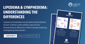LIPEDEMA & LYMPHEDEMA: UNDERSTANDING THE DIFFERENCES