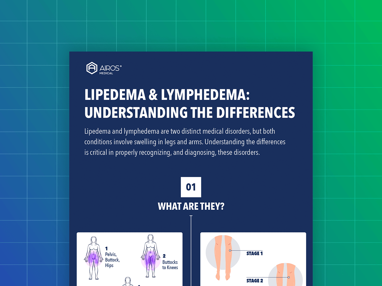 Lipedema & Lymphedema: Understanding The Differences