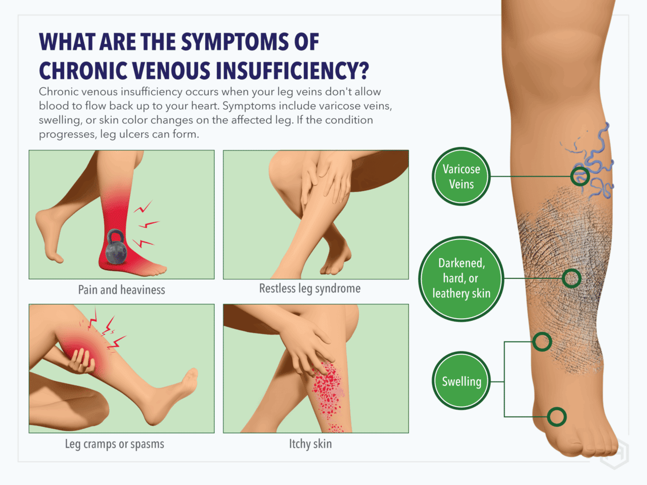 Skin changes associated with chronic venous insufficiency (CVI