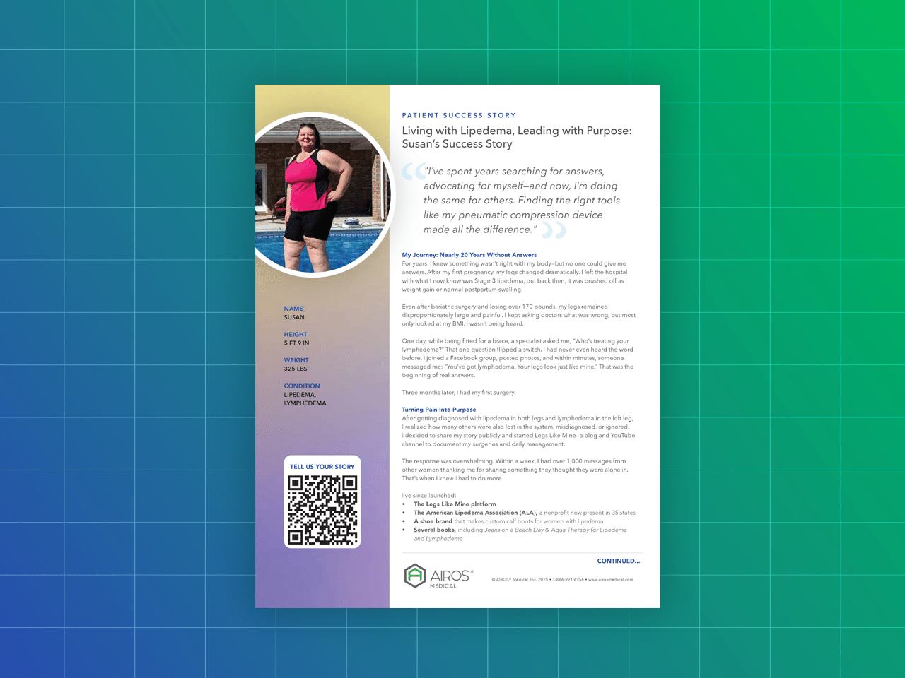 Living with Lipedema, Leading with Purpose: Susan’s Success Story